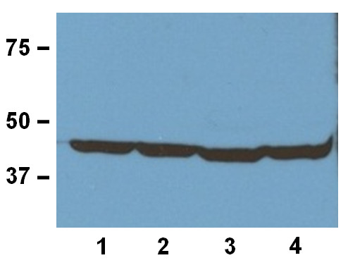 Western blot using anti-beta actin monoclonal antibodies